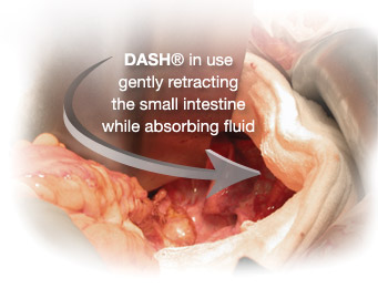 Dash In Use