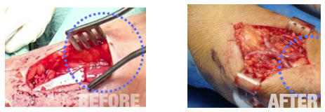 Reetrack Before and After