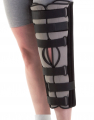 Knee