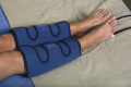 DVT Therapy