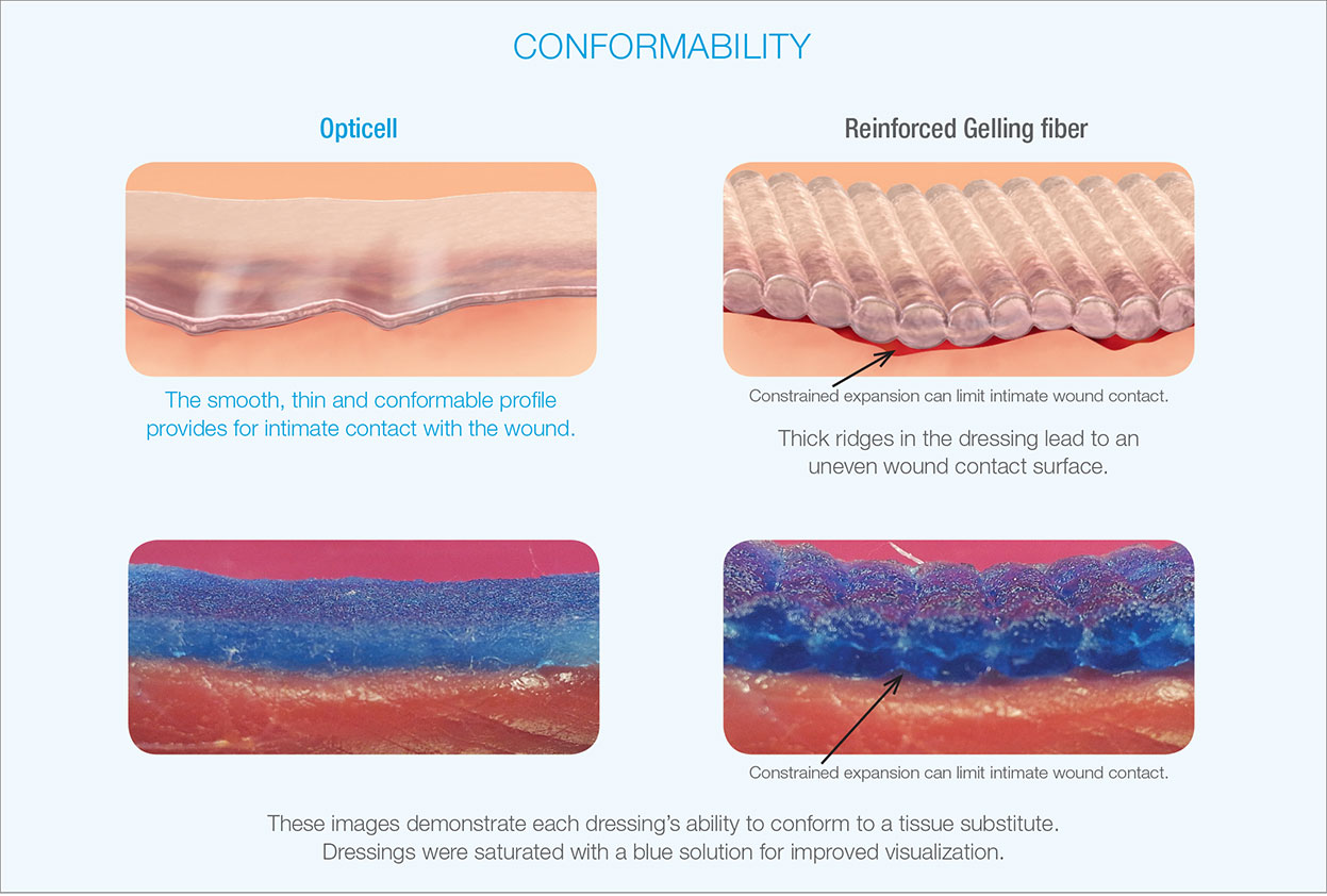 Opticell® AG+ Wound Dressings Medline Industries, Inc.