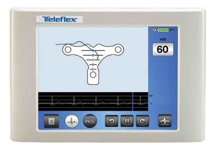 Teleflex Medical VPS Rhythm PICC Navigation Systems | Medline