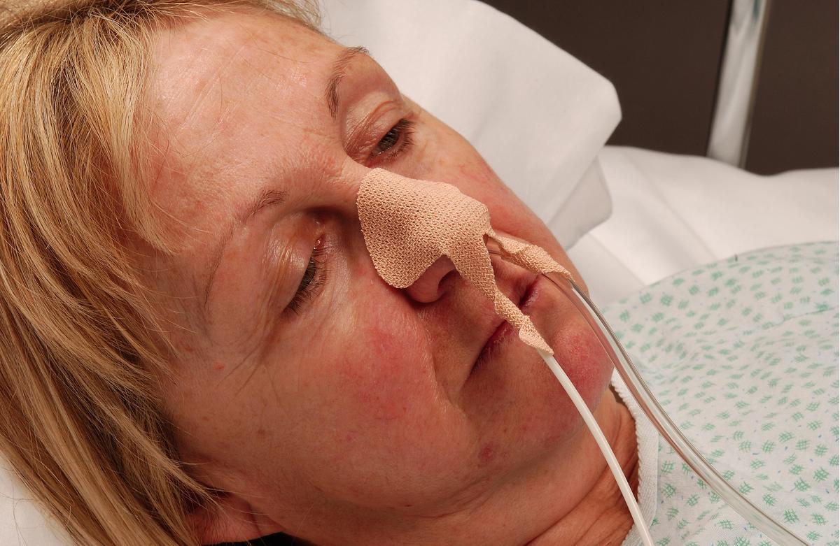 Nasogastric Tube Holders Medline Industries Inc