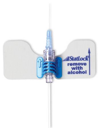 StatLock IV Select Stabilization Device with SmartSite | Medline