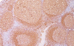CD79a Antibody | Medline Industries, Inc.