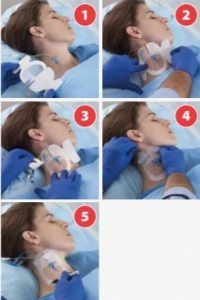 Cardinal Health Transparent Wound Dressings | Medline