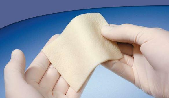 AlloMax Surgical Graft | Medline
