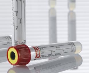 BLOODセット Z Serum Separator Clot Activator Tubes | Medline