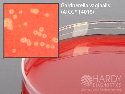 Hardy Diagnostics V. Agar with CNA | Medline