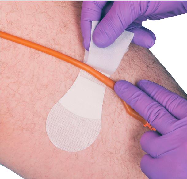 Large Foley Catheter Securements | Medline
