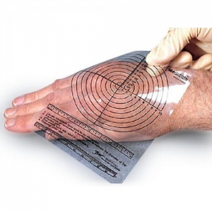 MediRule Wound Measurement Device | Medline Industries, Inc.