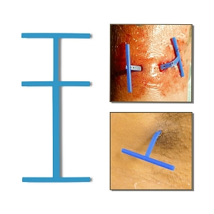Derma-Stent Abscess Drain | Medline Industries, Inc.