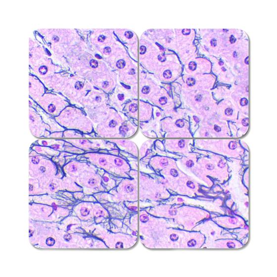 Chandler's Reticulum Kit | Medline
