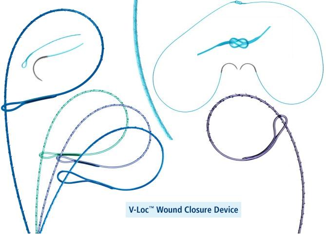V-Loc 180 Absorbable Suture Reloads | Medline