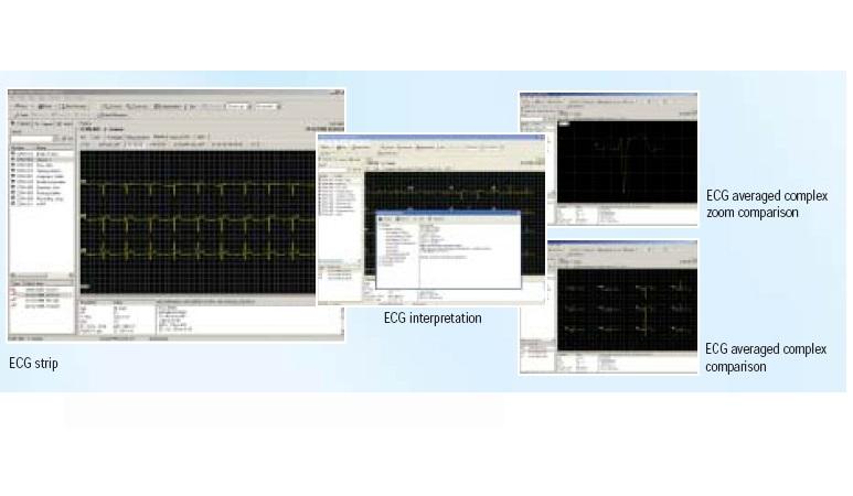 CardioPerfect Software and Updates | Medline