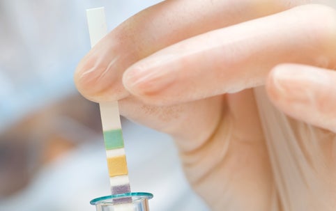 urine-test