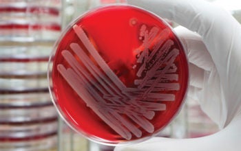 InfectionPrevention
