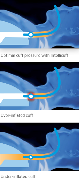 three-ways-of-breathing three-ways-of-breathing
