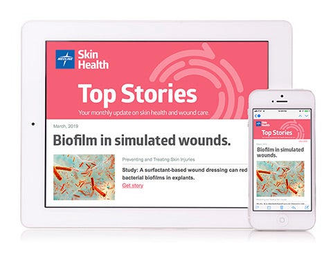 Computer tablet and smart phone displaying sample Medline Skin Health newsletter.