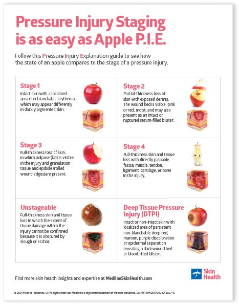 PST_SHD-May-Gated_Apple-Pie_RGB Hand holding apple to demonstrate wound staging printable poster.