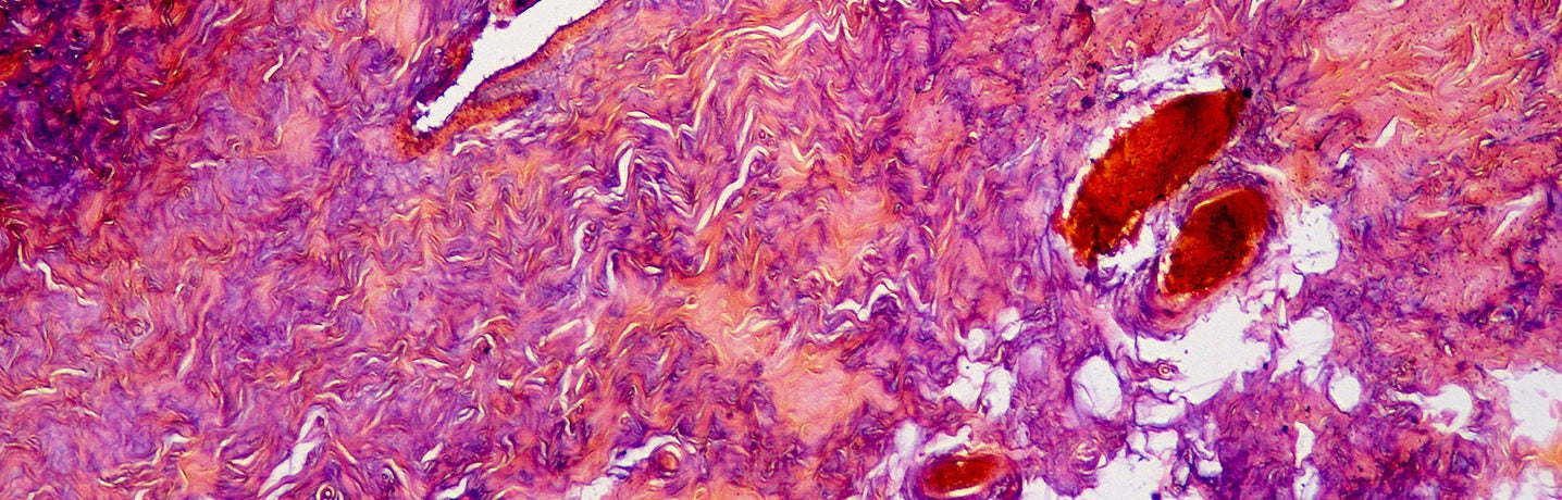 STK_Collagen_RGB Collagen