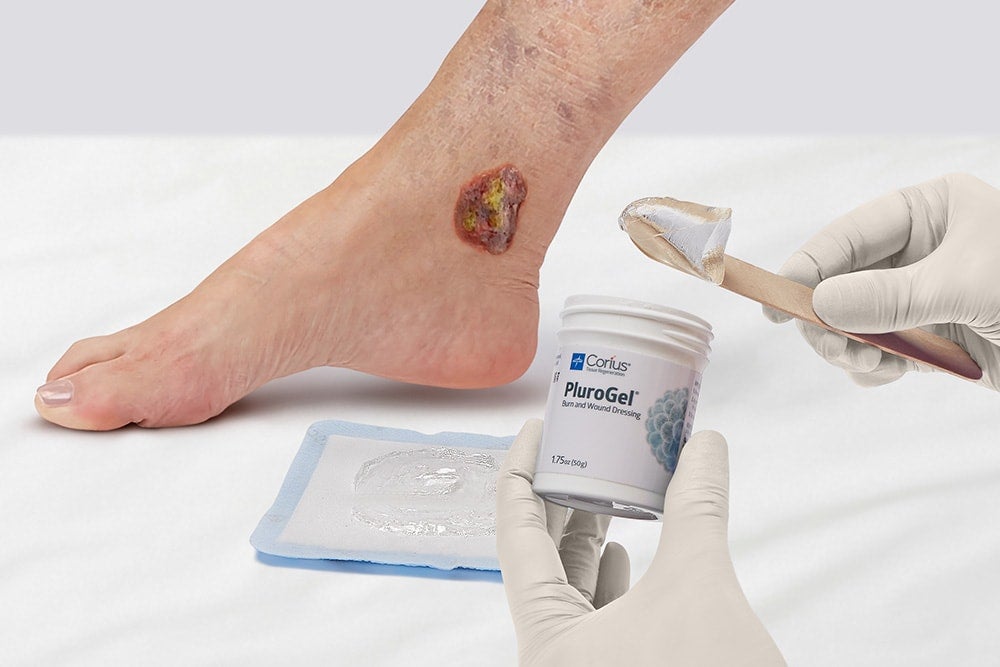 Advanced wound care overview Nurse applying Medline Plurogel to wound on patient leg.