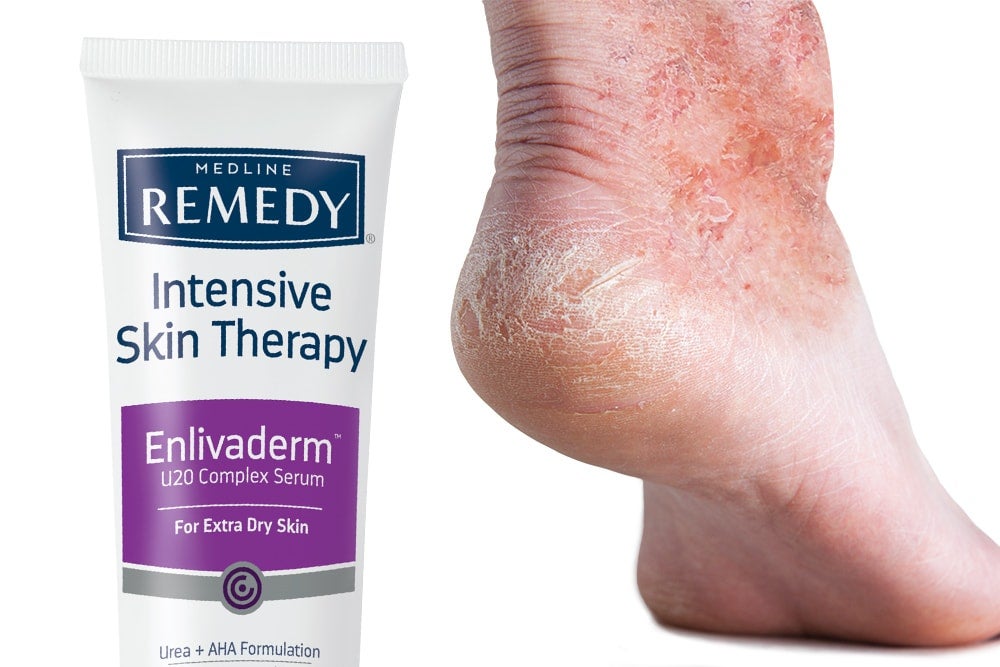 Bare foot and tube of Medline Enlivaderm.