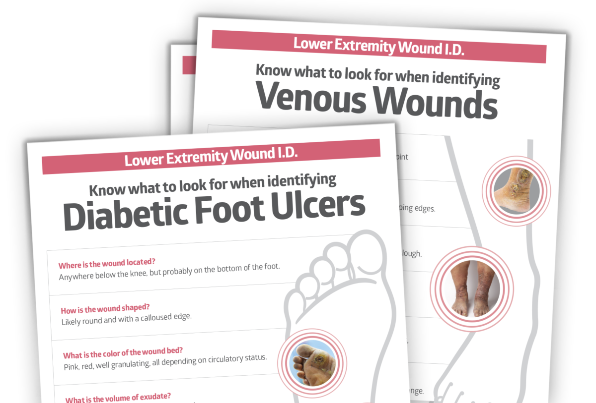 Venous Stasis Medline