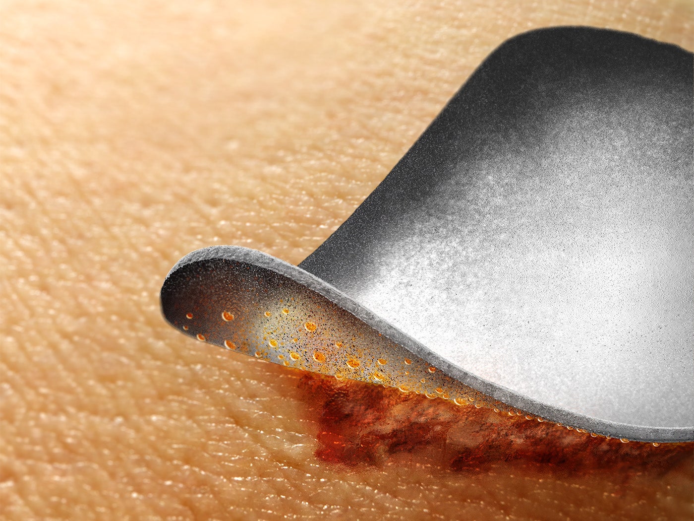 IoPlex on Skin