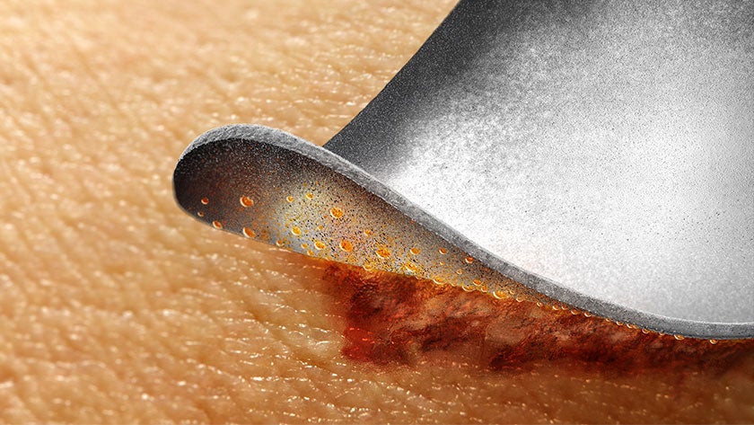 PAP_IoPlex-on-Skin_RGB_840x473