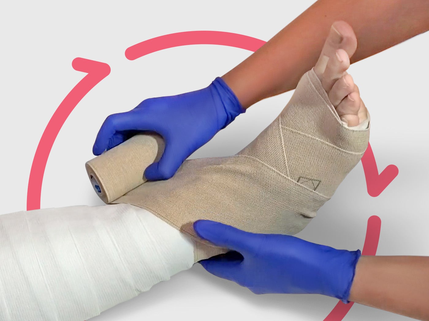 Venous stasis calls for compression: Use this chart to help choose the right solution for your patients