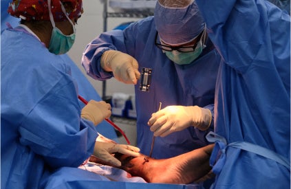 A team of clinicians doing surgery on a patient’s leg. A team of clinicians doing surgery on a patient's leg.