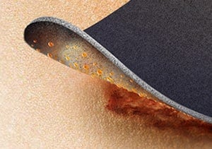 IoPlex Iodophor Foam Dressing with slow release iodine for wound healing IoPlex Iodophor Foam Dressing with slow release iodine for wound healing