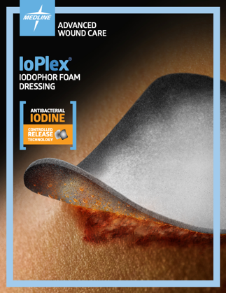 ioplex-information-sheet