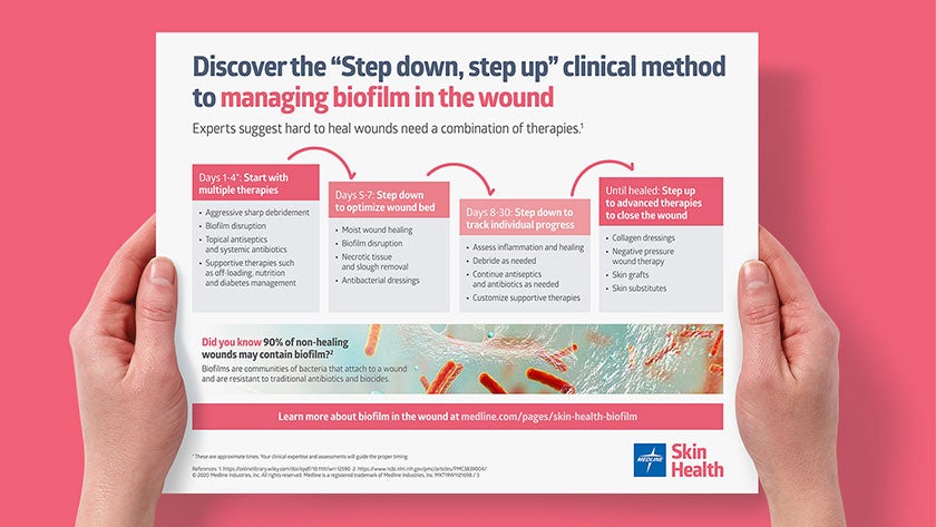 STK_Step-down-step-up_hands_840x473