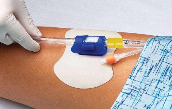 SKU_SAFESECURE_On-Leg_007_01-1-min Caregiver's gloved hand securing Foley catheter to patient's leg