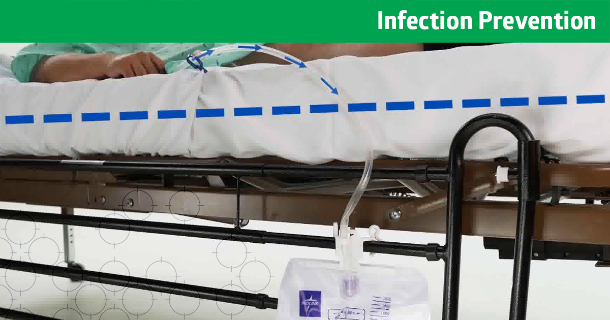 Beyond Foley insertion 5 practices to improve catheter care