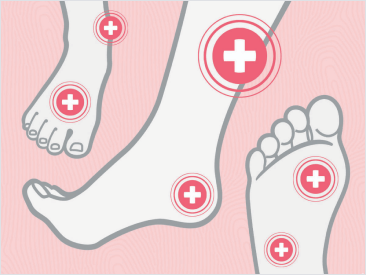Graphic of three feet and plus marks indicating where wounds could be Graphic of three feet and plus marks indicating where wounds could be