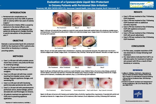 SAWC_3-posters_2
