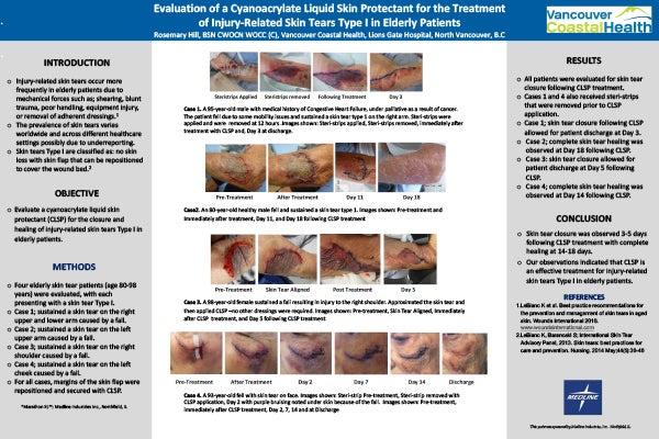 SAWC_3-posters_3