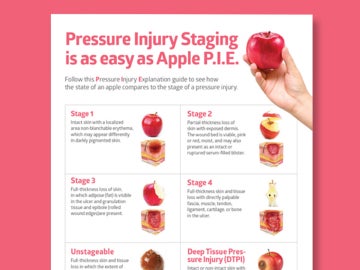 stage-pressure Thumbnail of pressure injury staging poster
