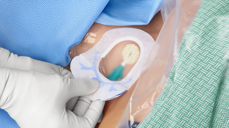 Scrub the hub and more: How to promote consistent practice
