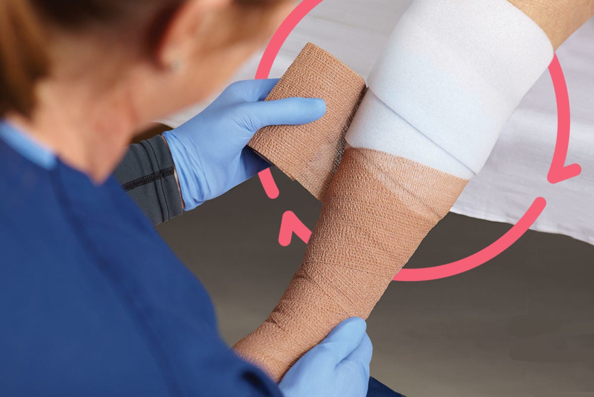 Choose the right compression wraps to help heal venous leg ulcers