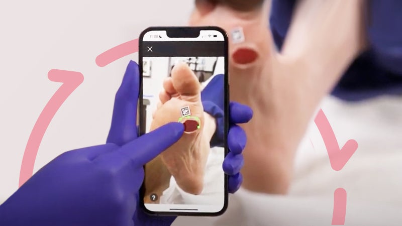 Skin Health: Digital Wound Photography - Medline