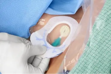 SorbaView Shield - Medline