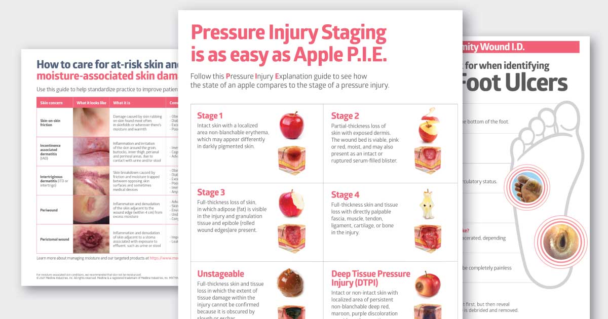 Skin and Wound Care Posters Medline