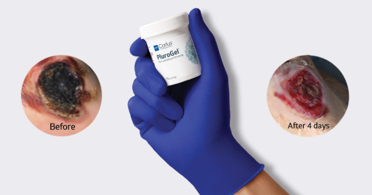 PluroGel® Burn and Wound Dressing Medline