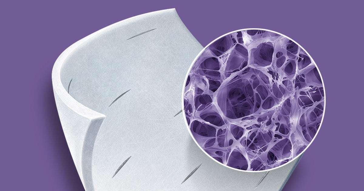 Break the Non-Healing Cycle With Puracol Collagen Wound Dressings