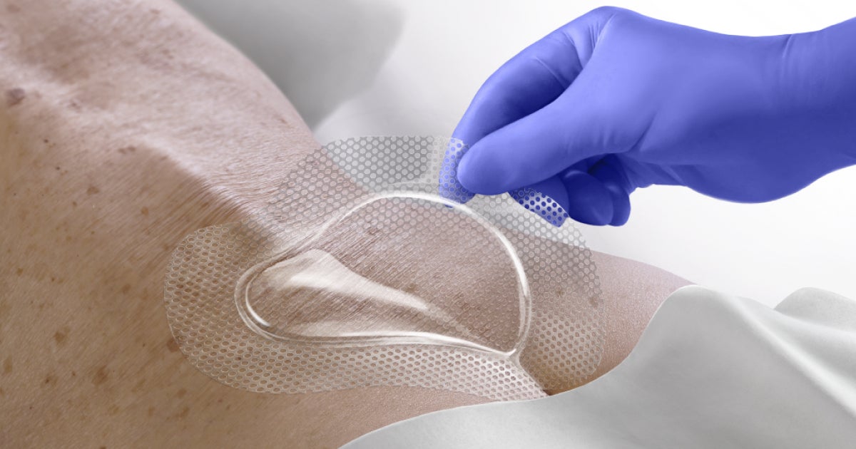 OptiView Transparent Dressing With HydroCore Technology optiview-transparent-dressing-with-hydrocore-technology