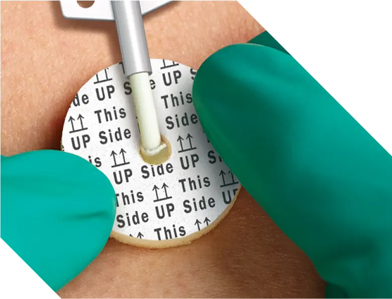 Aegis Chg Disc Medline